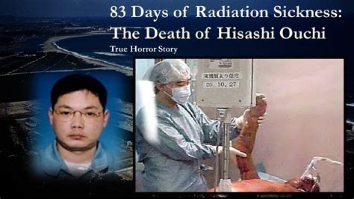 83 Days Hisashi Ouchi Photos: A Deep Dive Into A Tragic Story