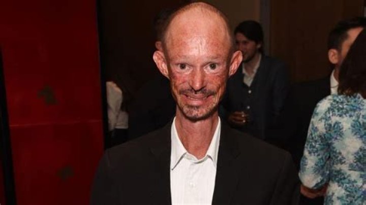 Acteur Darren Kent Maladie