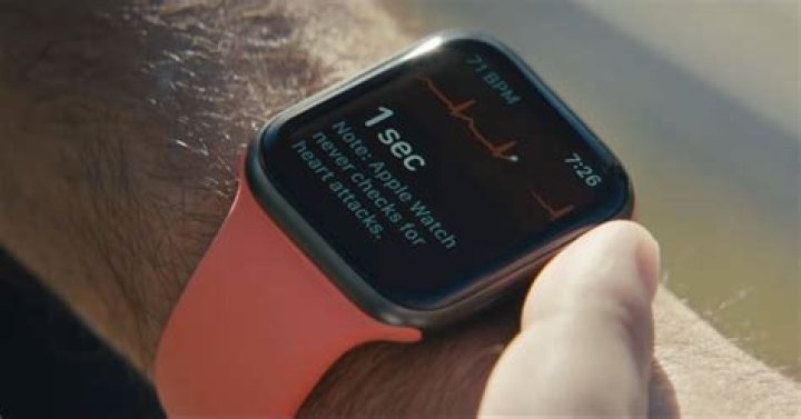 Apple Watch Users in Australia Can Now Use the ECG Feature
