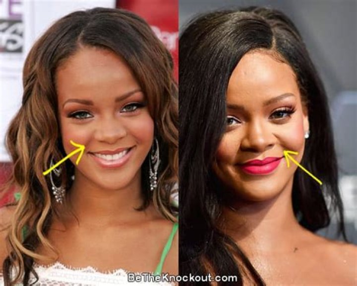 Behind Rihanna’s Nose Job And Plastic Surgery Speculations