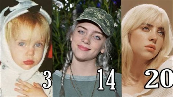 Billie Eilish's Stunning Transformation: The New Teeth Reveal