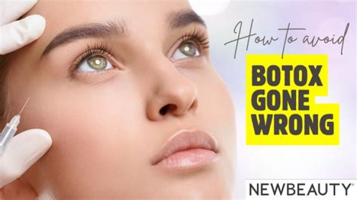 Botox Gone Wrong: Uncover The Hidden Dangers And Expert Solutions