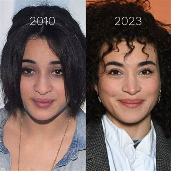 Camelia Jordana Chirurgie Esthétique