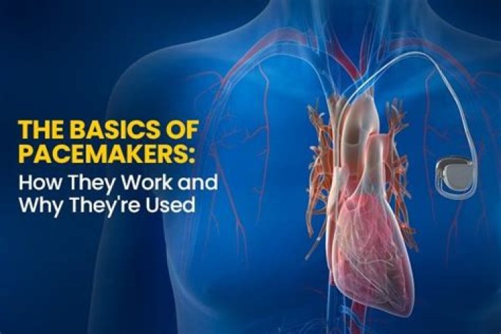 	CAN PEOPLE WITH PACEMAKERS HAVE HEART ATTACKS?	