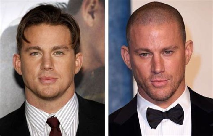 Channing Tatum Balding: Embracing Change With Style