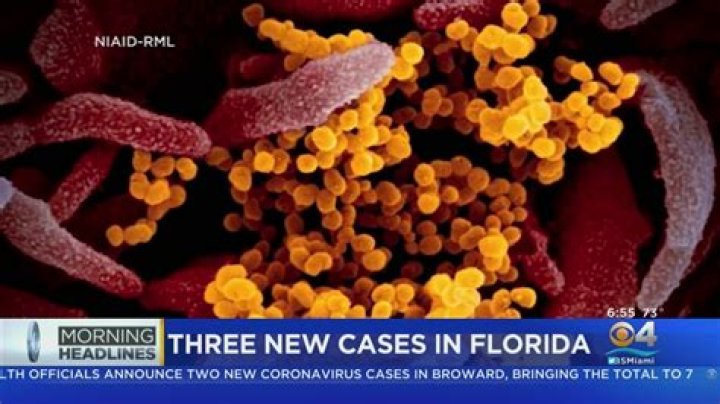 	COVID-19 update: Broward joins Miami-Dade as only two Florida counties with ‘moderate’ risk levels	