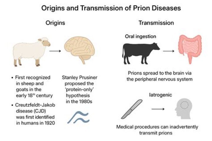 Developing a technique to detect early signs of prion diseases