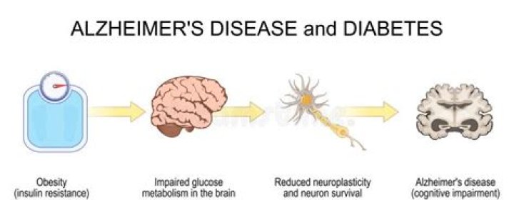Diabetes | Alzheimer's Society