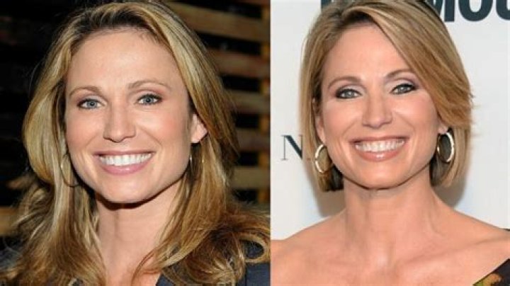 Did Amy Robach Undergo Surgery For Face Or Another Underlying Reason?