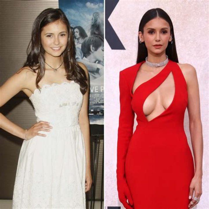 Did Nina Dobrev Get Plastic Surgery? Debunking The Rumors