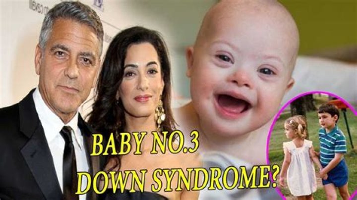 Does George Clooney's Twins Have Down Syndrome? Understanding The Truth Behind The Rumors