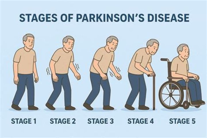 Does Mark Levin Have Parkinson's Disease? A Comprehensive Analysis