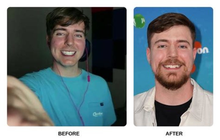 Does Matt Rife have fake teeth? Before and after pictures show stark difference