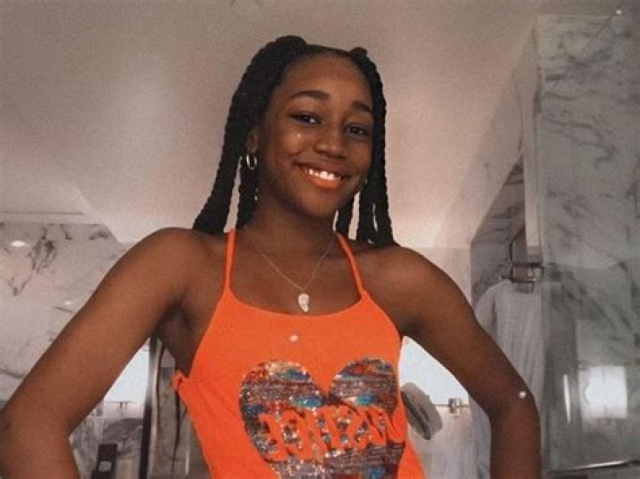 Doubling Down with the Derricos fans praise Darian as she opens up about Eczema