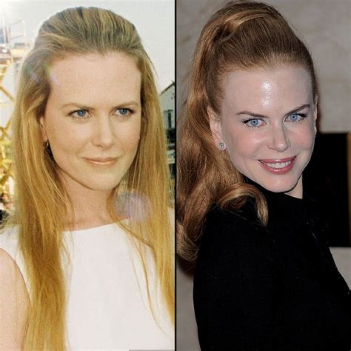 Exploring The Formative Years Of Nicole Kidman
