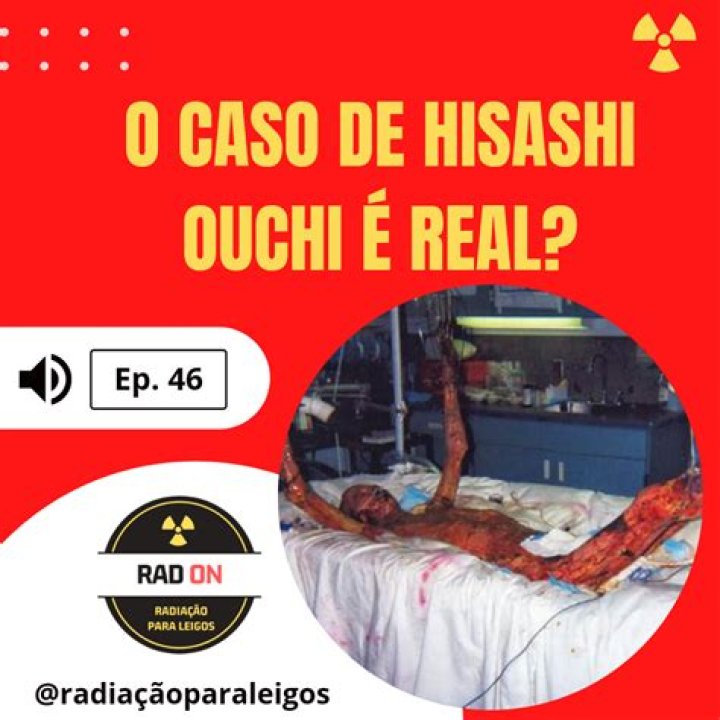 Hisashi Ouchi Original Photo: A Deep Dive Into The Life And Legacy