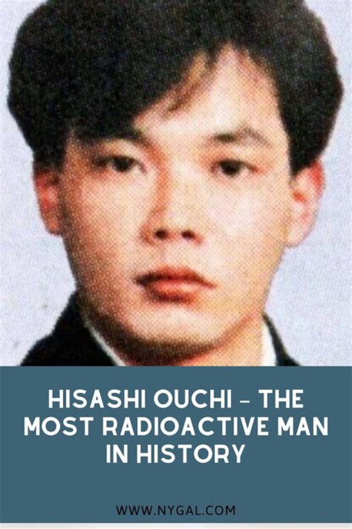 Hisashi Ouchi: The Real Photos And Story Behind The Tragic Accident
