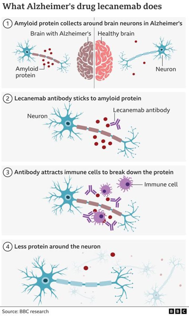 Investigating how to clear toxic amyloid protein from the brain in Alzheimer’s disease