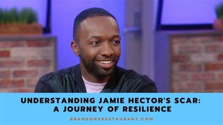 Jamie Hector Scar: The Untold Story Behind The Iconic Actor