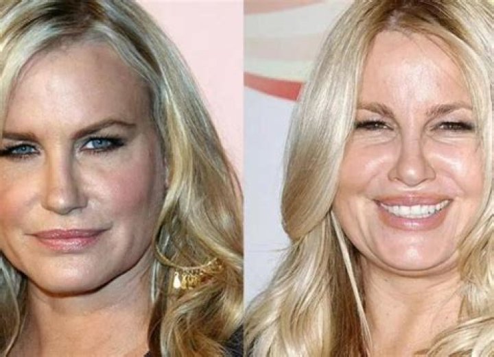Jennifer Coolidge's Facelift: A Journey Of Transformation