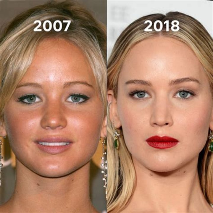 Jennifer Lawrence Chirurgie