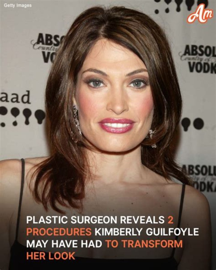 Kimberly Guilfoyle Before Surgery: A Comprehensive Look At Her Transformation