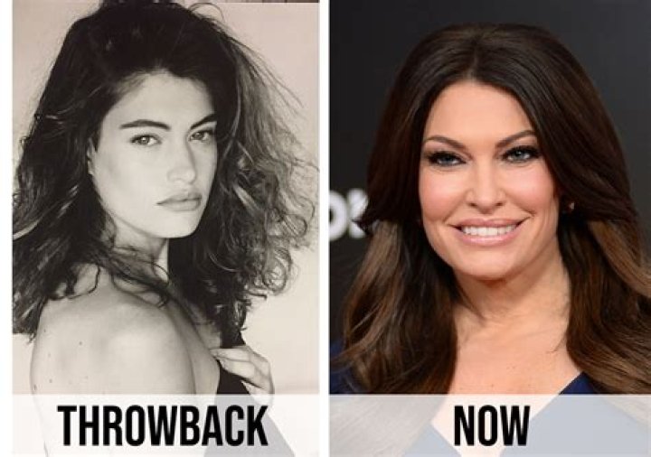 Kimberly Guilfoyle Plastic Surgery 2024: A Comprehensive Review