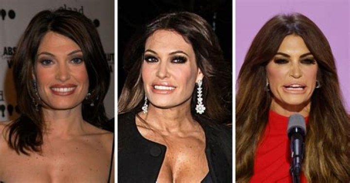 Kimberly Guilfoyle Plastic Surgery: A Comprehensive Look At Her Transformation