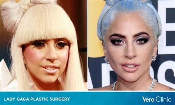 Lady Gaga Weight: A Comprehensive Guide To Her Fitness Journey