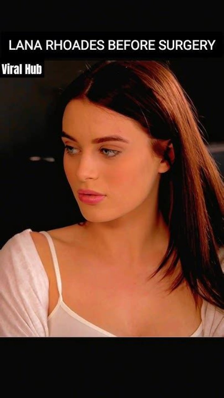 Lana Rhoades Surgery: Everything You Need To Know