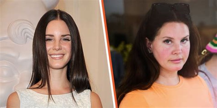 Lana Weight Gain: Uncovering Truths And Empowering Acceptance