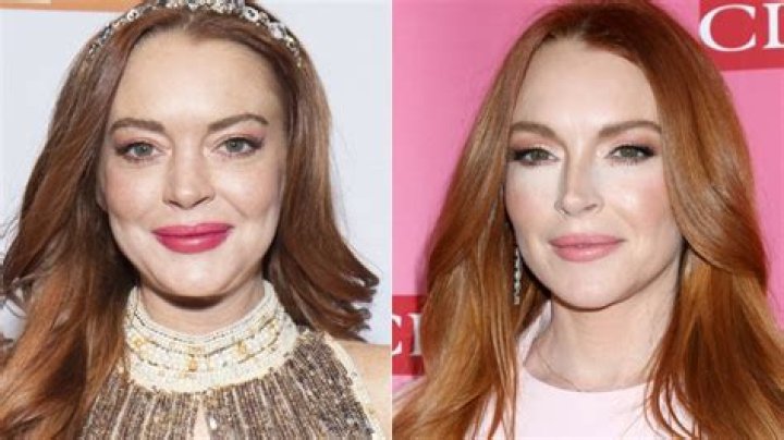 Lindsay Lohan's Plastic Surgery Journey: Uncovering Transformation And Empowerment