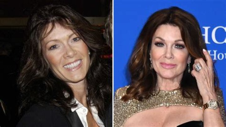Lisa Vanderpump Before And After Facelift: Did She Do Surgery?