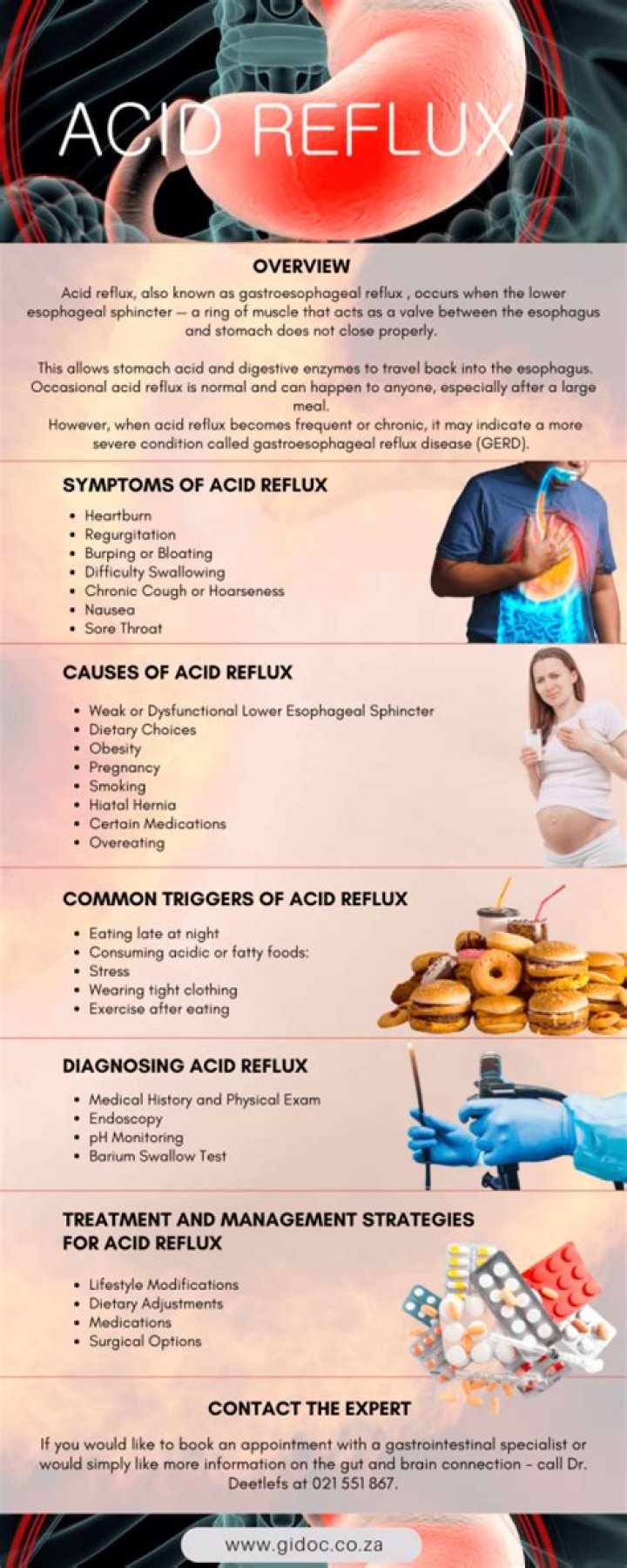 	Managing acid reflux with less medicine	