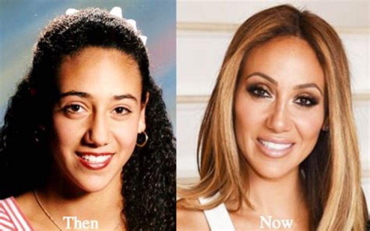 Melissa Gorga Admitted Getting Plastic Surgery And Nose Job