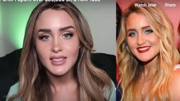 Mia Dio's Face Before Surgery Looked Completely Different