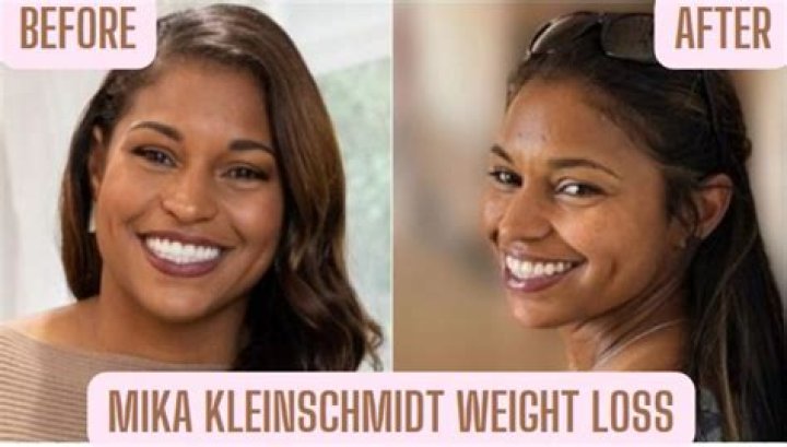 Mika Kleinschmidt Weight Loss: A Transformational Journey