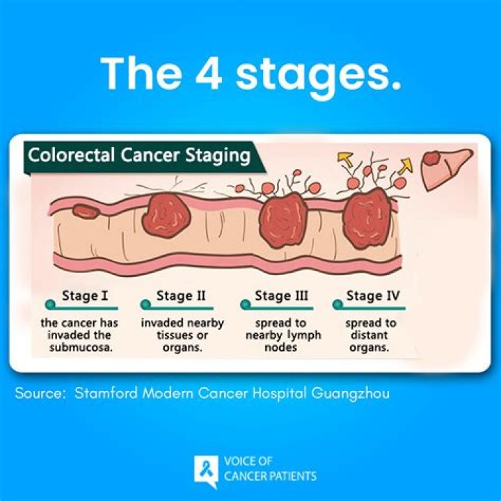 Pioneer Woman: A Journey Through Stage 4 Colon Cancer