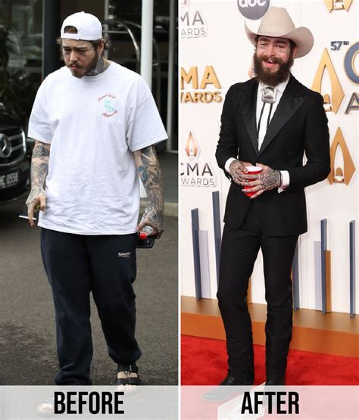Post Malone Before And After: A Transformation Journey