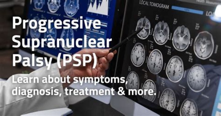 Progressive supranuclear palsy (PSP) | Alzheimer's Society