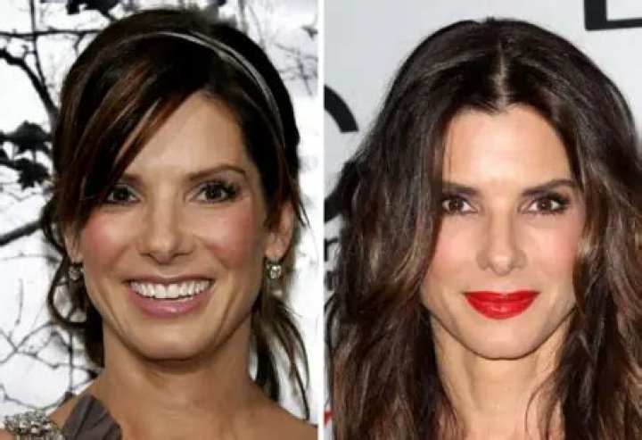 Real Truths Behind Sandra Bullock's Plastic Surgery