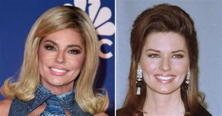 Revealing The Truth: Shania Twain Plastic Surgery Unveiled