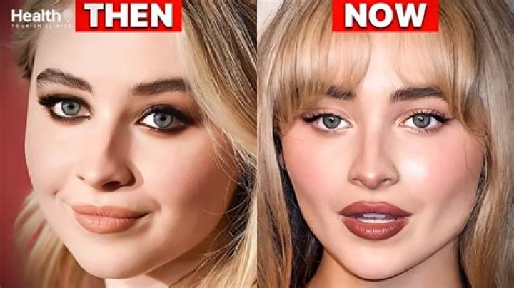 Sabrina Carpenter's Journey: Pre-Surgery Insights