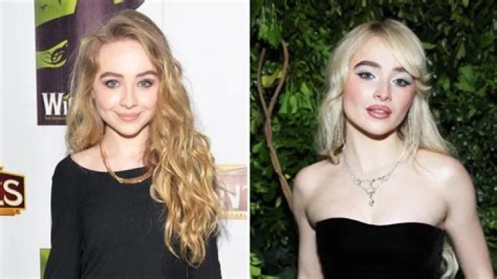 Sabrina Carpenter Chin Implant: The Transformation Journey