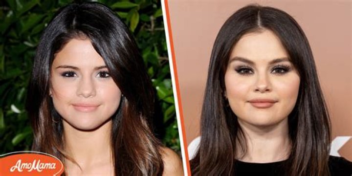Selena Gomez’s Rumors Of Plastic Surgery And Weight Loss
