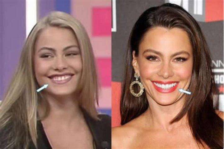 Sofia Vergara’s Boob Job: Everything You Need To Know