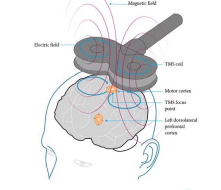 Therapy and approaches for memory loss support