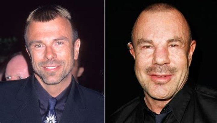 Thierry Mugler Chirurgie