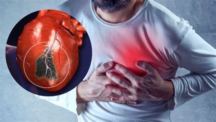 Understanding Ben Napier's Health Journey: The Heart Attack Incident