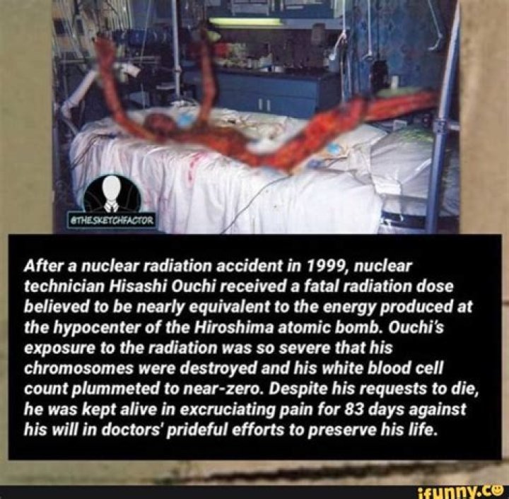 Understanding Hisashi Ouchi: A Glimpse Through Photos After Radiation